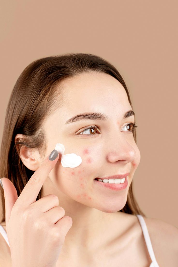 Acne Control Routine